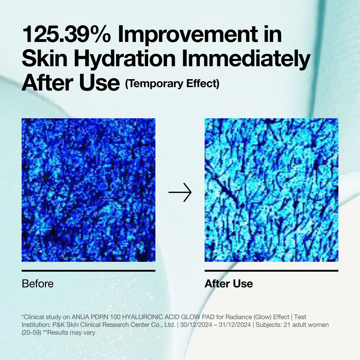 ANUA PDRN 100 Hyaluronic Acid Glow Pads - 60P/180ml